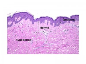 Epi derme hypo