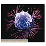 Le Corps Humain : Cancer – Les tumeurs malignes