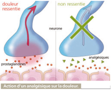 douleur