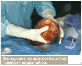 greffe d'organe